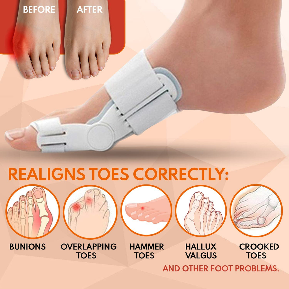 Bunion Pain Relief Toe Corrector