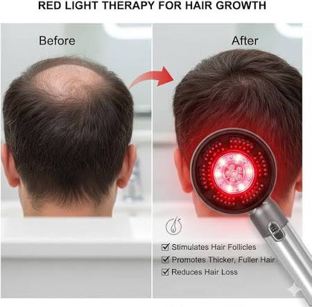Electric Hair Growth Scalp Massager Comb with LED Light Therapy